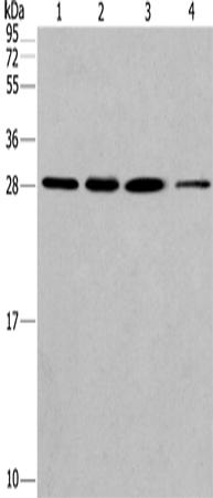 兔抗ERP29多克隆抗体