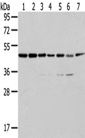 兔抗ERP44多克隆抗体