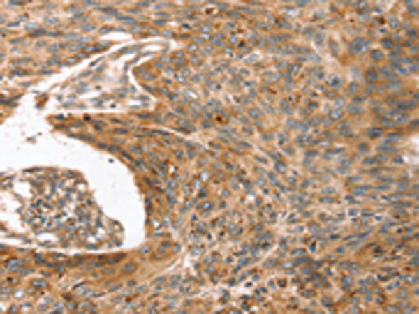 兔抗ERVW-1多克隆抗体