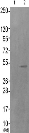 兔抗ESR1(Phospho-Ser102)多克隆抗体