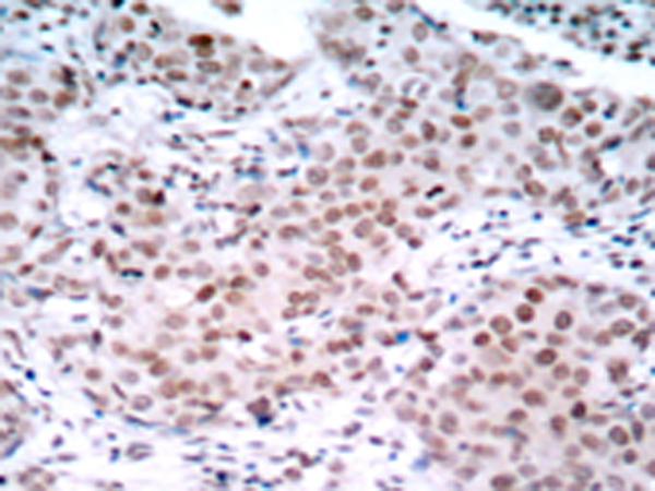 兔抗ESR1(Phospho-Ser104)多克隆抗体
