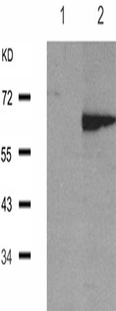 兔抗ESR1(Phospho-Ser104)多克隆抗体