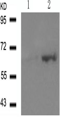 兔抗ESR1(Phospho-Ser118)多克隆抗体