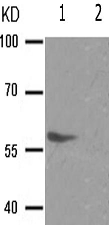 兔抗ESR2(Phospho-Ser105)多克隆抗体
