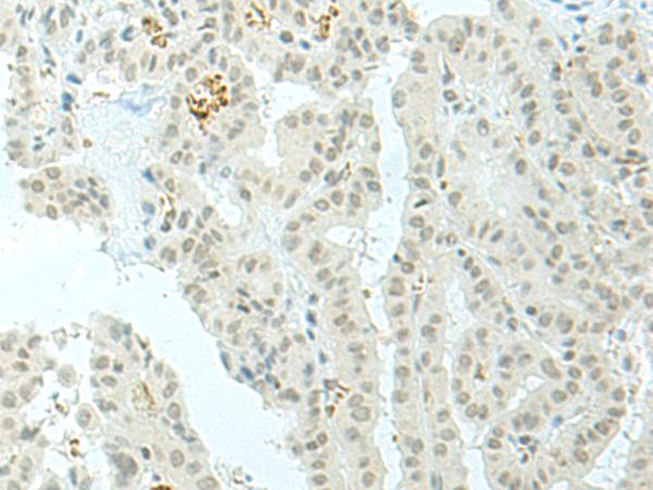兔抗ESRP2多克隆抗体