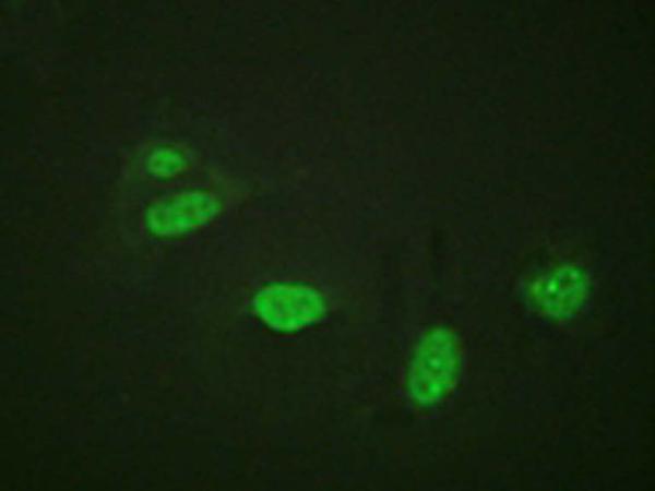 兔抗ETS1(Phospho-Thr38)多克隆抗体