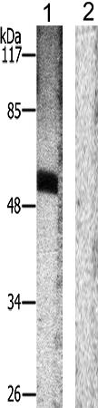 兔抗ETS1(Phospho-Thr38)多克隆抗体