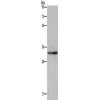 兔抗CLDN23多克隆抗体