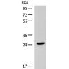 兔抗CLEC9A多克隆抗体