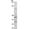 兔抗CLN6多克隆抗体