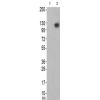 兔抗EPHA2/5(Ab-594)多克隆抗体