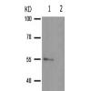 兔抗EPOR(Phospho-Tyr368)多克隆抗体