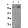 兔抗ERBB2(Phospho-Tyr1221/Tyr1222)多克隆抗体