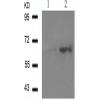 兔抗ESR1(Phospho-Ser118)多克隆抗体