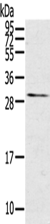 兔抗TNFSF15多克隆抗体 