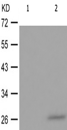 兔抗TNNI3(Phospho-Ser43) 多克隆抗体