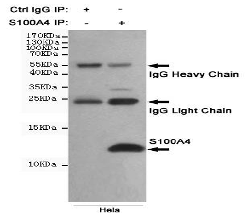 小鼠抗S100A4单克隆抗体