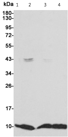 小鼠抗S100A6单克隆抗体