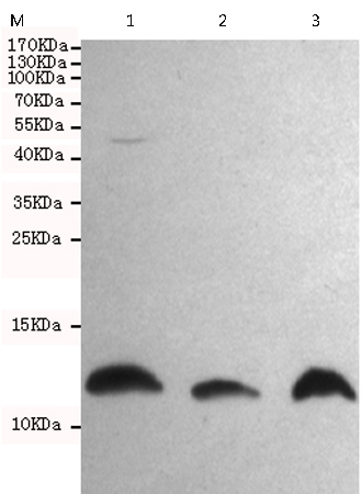 小鼠抗S100A10单克隆抗体
