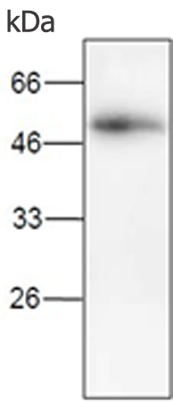 小鼠抗SERPINE1单克隆抗体 