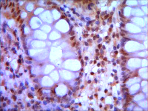 小鼠抗SMC1A(N-term)单克隆抗体