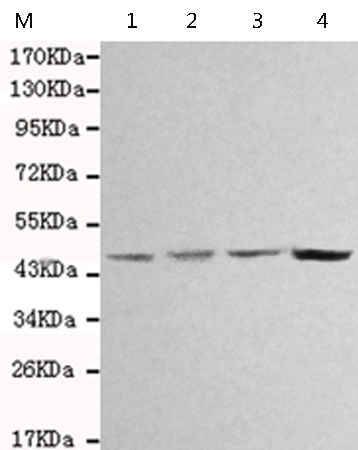 小鼠抗SMYD2单克隆抗体  