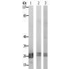 兔抗TNFSF12多克隆抗体
