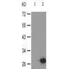 兔抗TNNI3(Phospho-Thr142) 多克隆抗体