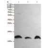 小鼠抗S100A10单克隆抗体
