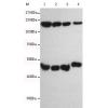 小鼠抗NFKB1单克隆抗体  