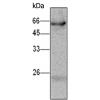 小鼠抗SERPINB4单克隆抗体  