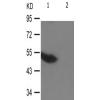 兔抗TP53(Phospho-Ser20) 多克隆抗体 