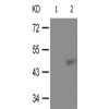 兔抗TP53(Phospho-Ser366) 多克隆抗体 