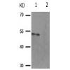 兔抗TP53(Phospho-Ser392) 多克隆抗体