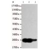 小鼠抗UCHL1单克隆抗体