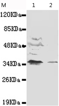 小鼠抗NFKBIA(N-term)单克隆抗体  