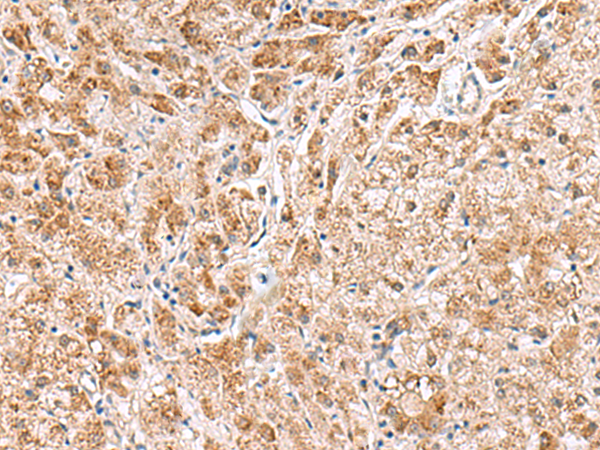 兔抗HMGCLL1多克隆抗体