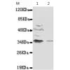 小鼠抗NFKBIA(N-term)单克隆抗体  