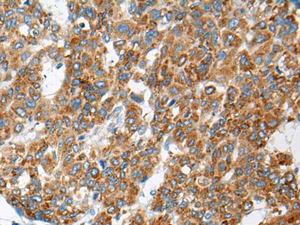 兔抗CEP104多克隆抗体