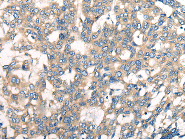 兔抗CNTNAP1多克隆抗体