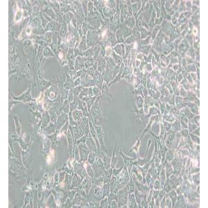 HCC827人非小细胞肺癌细胞