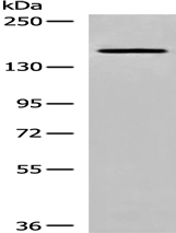 Anti-DIP2B antibody