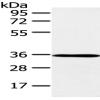 Anti-E2F5 antibody