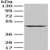 Anti-SLC2A6 antibody