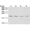 Anti-KLRC2 antibody