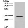 Anti-DPPA4 antibody