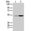 Anti-EGR2 antibody