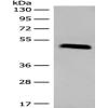 Anti-IFNGR1 antibody
