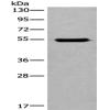 Anti-CYP11B2 antibody