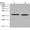 Anti-CDKL1 antibody